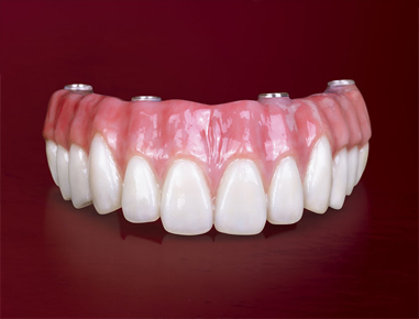Modern technology has improved the quality and strength of the dentures to....