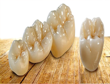 Crown / bridge restore the appearance and function of weak, misshapen, missed or cracked teeth.